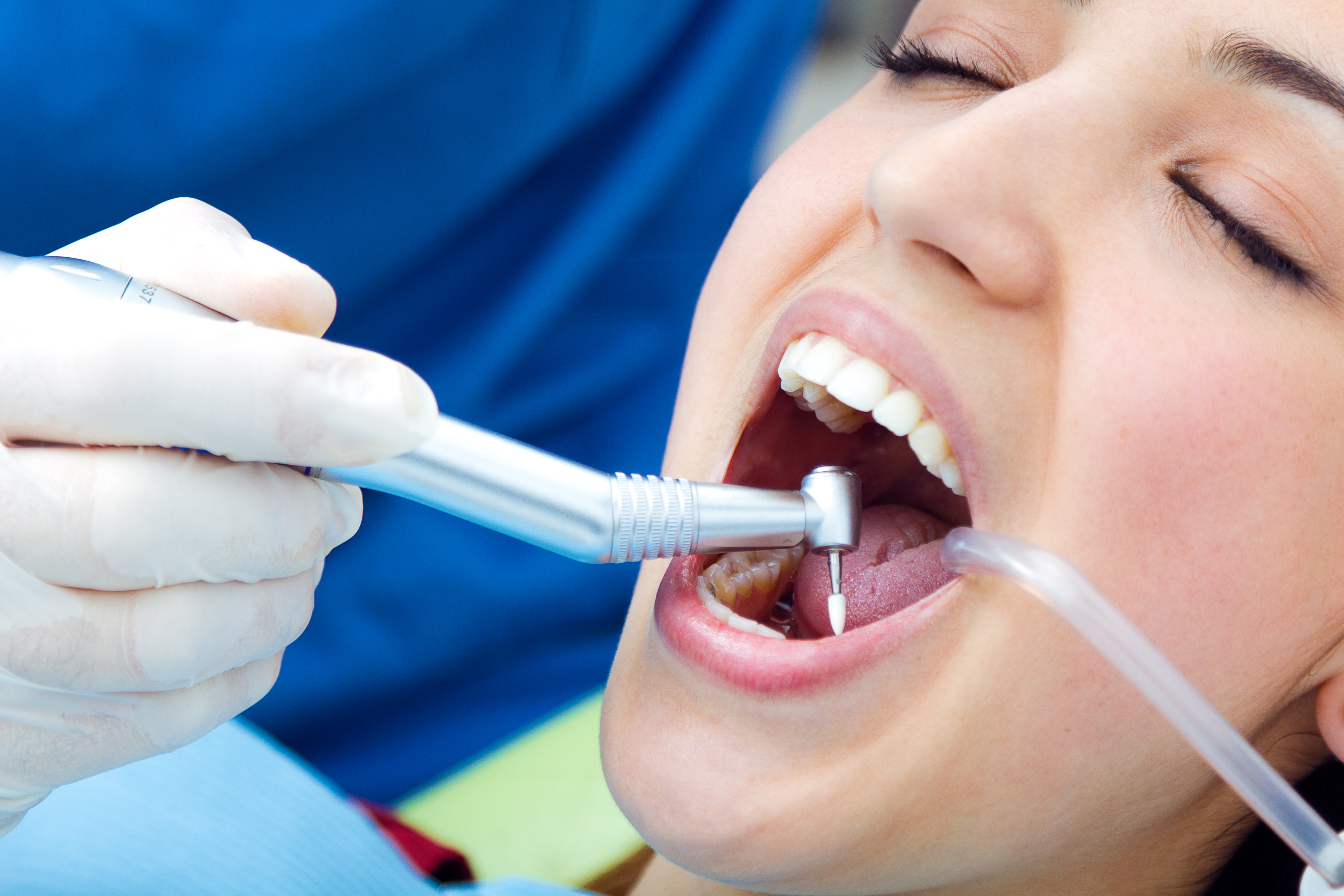 Dental Extraction