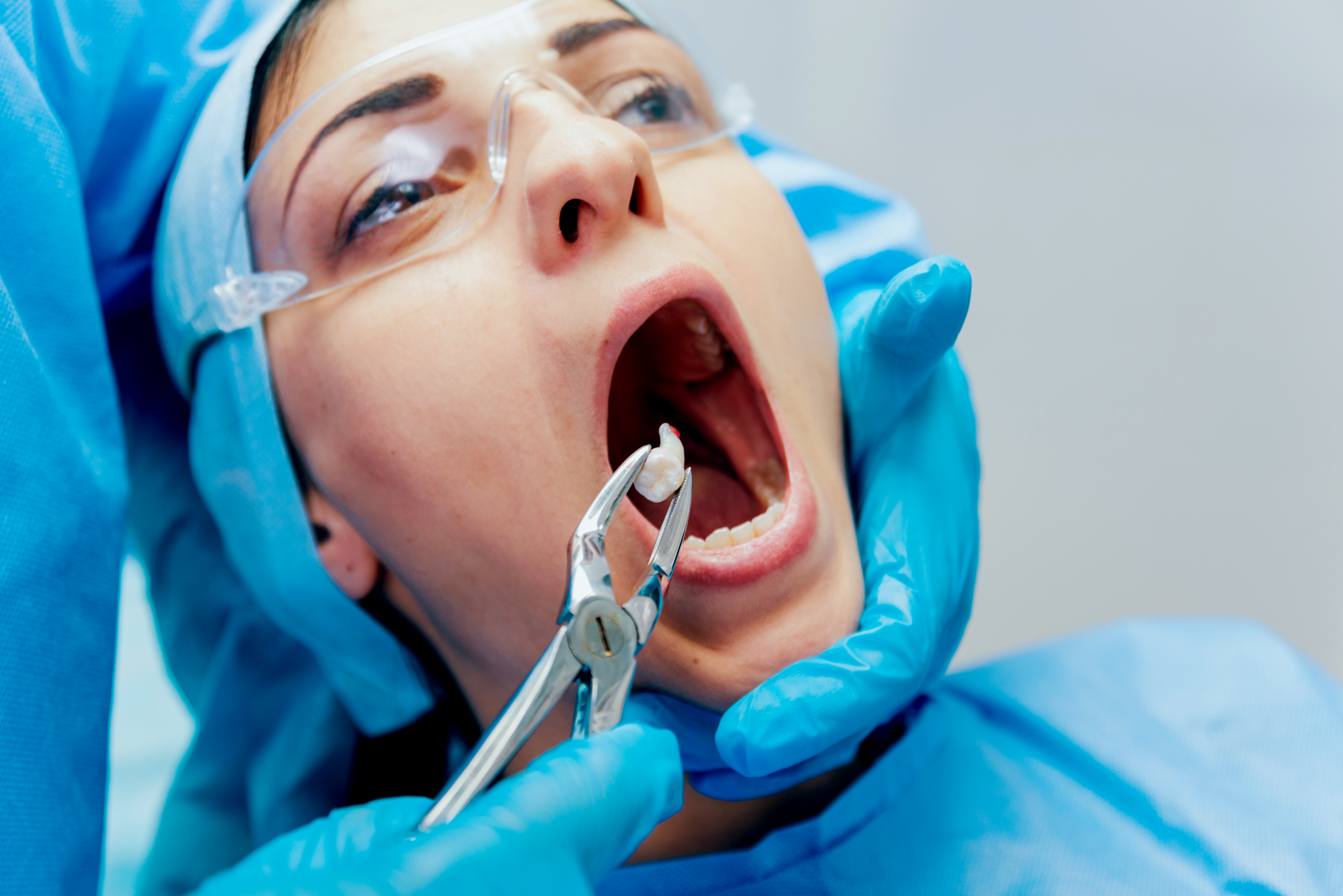 Root Canal Treatment